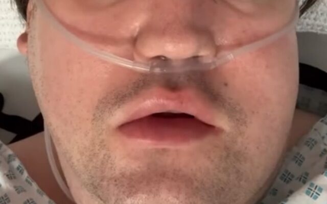 Nicolás Yunge en UCI tras procedimiento dental: "Estoy contento con la vida que tuve"