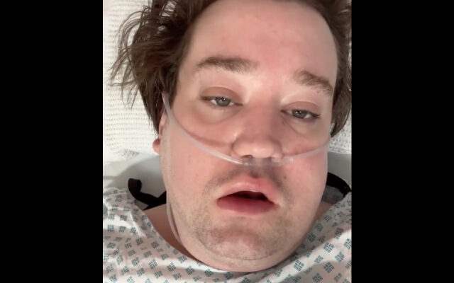 Nico Yunge internado en la UCI de un hospital de Londres tras procedimiento dental