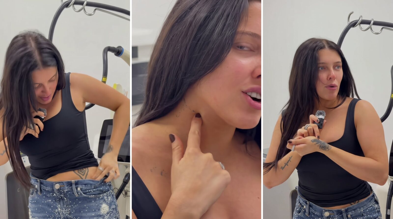 La Reini muestra su tercera sesión para borrar los tatuajes de su pasado tumbero